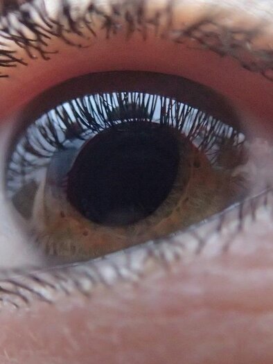 A close-up view of a human eye with long eyelashes and a clear pupil. The iris displays an interesting color pattern. | © Augenarzt